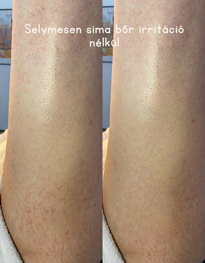 Selymesen sima bőr irritáció nélkül