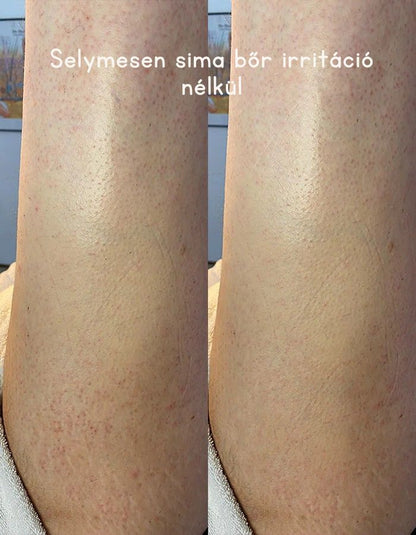 Selymesen sima bőr irritáció nélkül