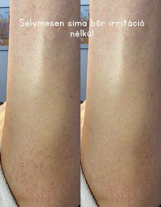 Selymesen sima bőr irritáció nélkül